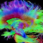 دانشمندان قسمتی از مغز که هوشیاری به آن مربوط است را پیدا کردند