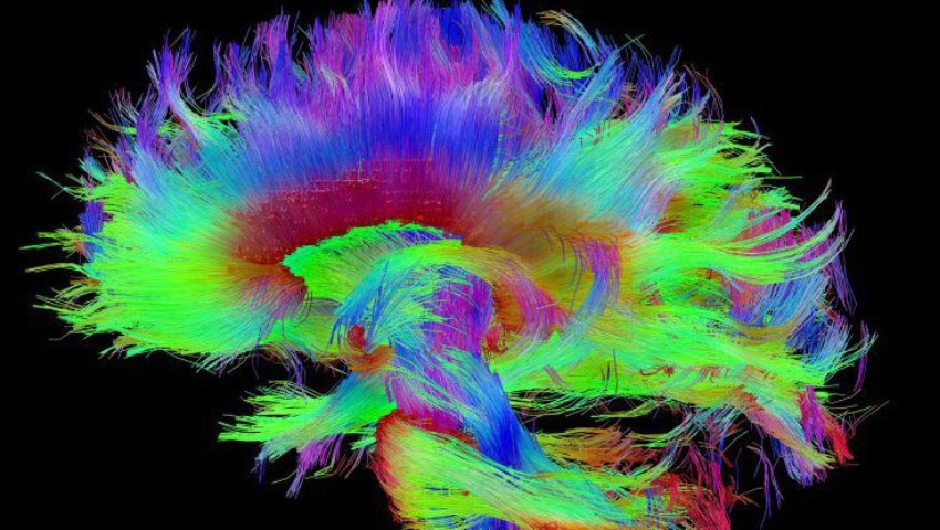 دانشمندان قسمتی از مغز که هوشیاری به آن مربوط است را پیدا کردند