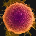 نانوسیک‌هایی که نحوه مقابله با سرطان را به بدن آموزش می‌دهند