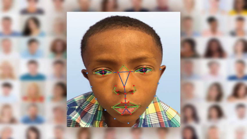 استفاده از فناوری تشخیص چهره برای شناسایی بیماری نادرژنتیکی!