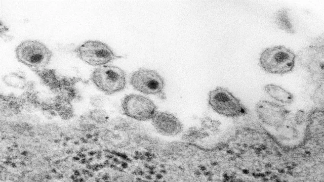درمان جدیدی برای HIV، فاز یک آزمایشات را با موفقیت پشت سر گذاشت