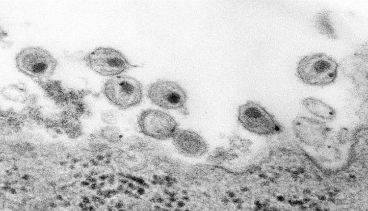 درمان جدیدی برای HIV، فاز یک آزمایشات را با موفقیت پشت سر گذاشت
