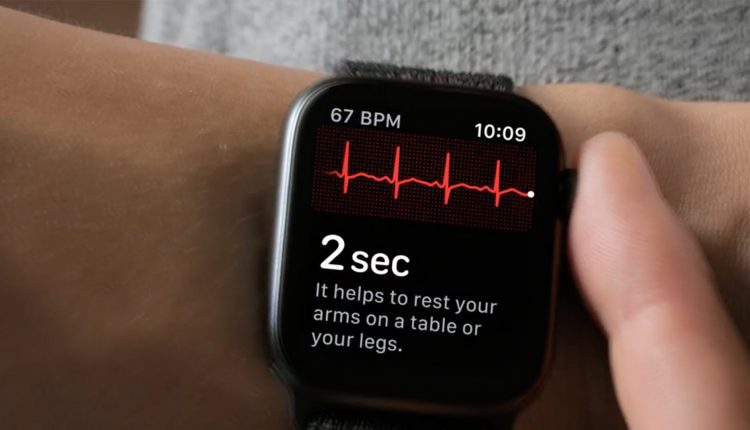 اپل واچ