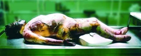 باد کردن جسد پس از مرگ