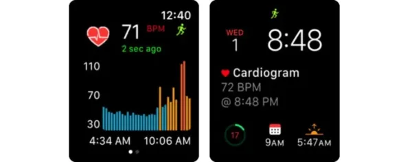 Cardiogram