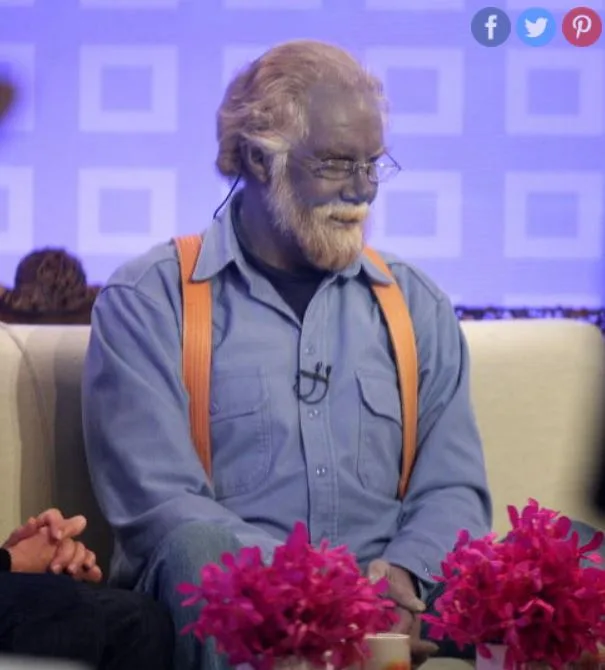 Argyria