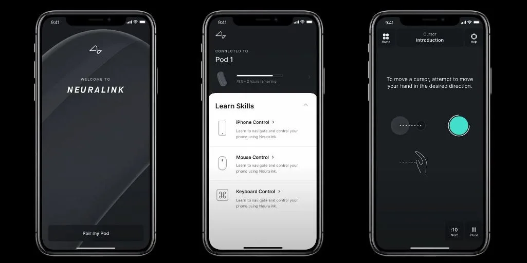 نورالینک چیست؟ 4