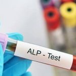تشخیص بیماری های کبد با آزمایش ALP