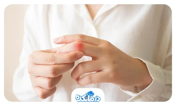 چگونه انواع بیماری آرتروز Arthritis سلامتی شما را تهدید میکنند؟