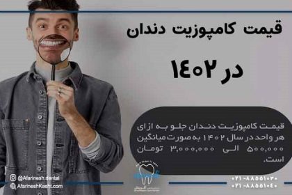 قیمت کامپوزیت دندان در سال 1402