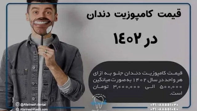قیمت کامپوزیت دندان در سال 1402