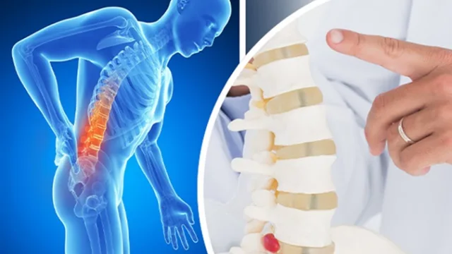 آیا ماساژور برای دیسک کمر ضرر دارد؟