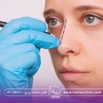 مدل بینی برای عمل