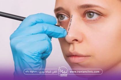 مدل بینی برای عمل