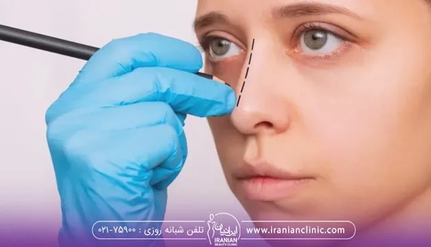 مدل بینی برای عمل