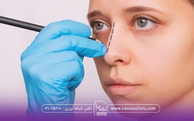 مدل بینی برای عمل