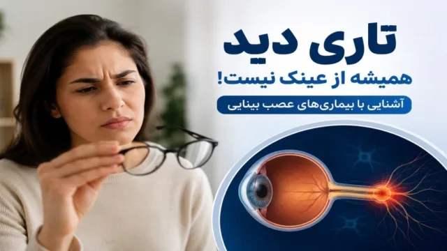 تصویر گرافیکی از ساختار عصب بینایی که ارتباط میان چشم و مغز را برای تشخیص علت تاری دید نشان می‌دهد